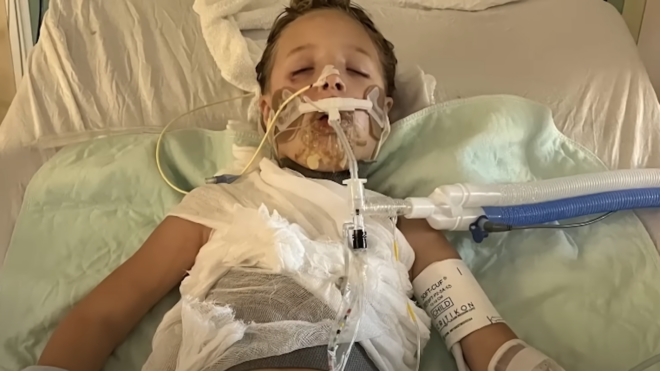 Girl who got burned after microwaving popular squishy toy